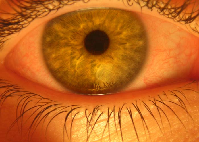 О скорости, силе проявления «прихода»